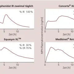 Diagramme zeigen MPH-Plasmakonzentration über Zeit für verschiedene Medikamente. Medikinet Ritalin Unterschied wird durch unterschiedliche Freisetzungsanteile (IR/ER) verdeutlicht.
